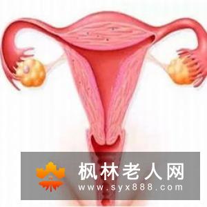 卵巢囊肿会有哪些症状