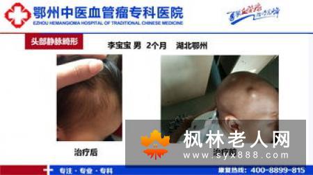 按年龄分类更年期的表现症状
