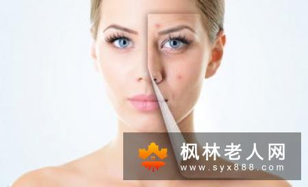 浓妆是汗腺分泌的阻碍  警惕夏季化浓妆出现中暑