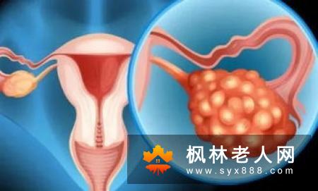 哪些食物对多囊卵巢女性怀孕有益呢？