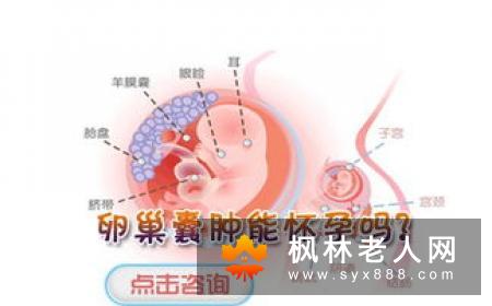 导致卵巢囊肿的因素