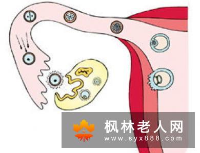 卵巢黄体破裂的症状有哪些