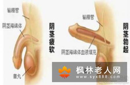 夜晚阴茎勃起一直是阳痿检查中常用的测试方法