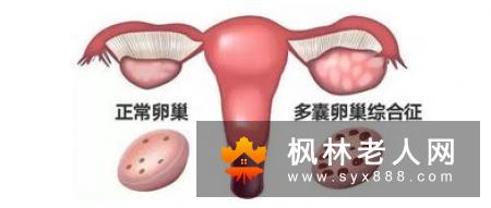 女性不孕的影响因素有哪些 警惕“香水有毒”