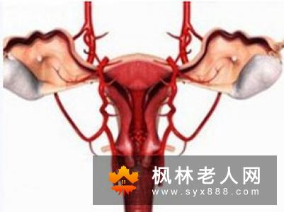 卵巢囊肿的发病预兆有哪些