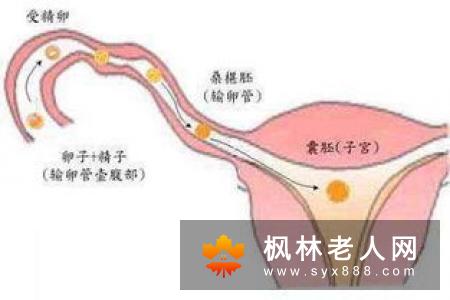 女性盆腔做好保养的好处会有哪些