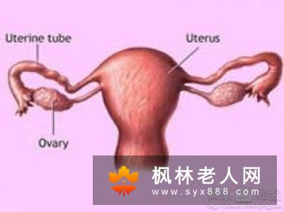 卵巢囊肿的严重危害