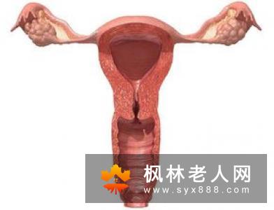 患上卵巢囊肿以后会有哪些发病的特点