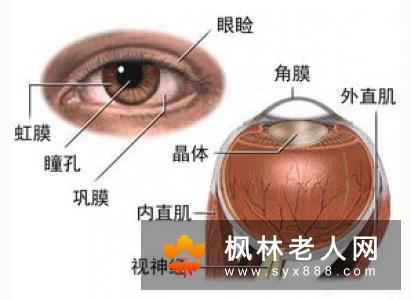 白内障的临床表现会是什么呢