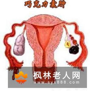 卵巢囊肿有哪些早期症状