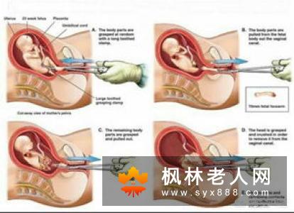 卵巢保养的错与对