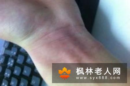 老年痴呆的发病原因有哪些