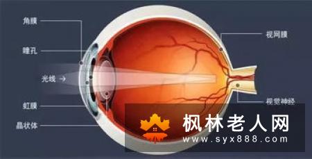 白内障的几点事项应十分关注和认真做到