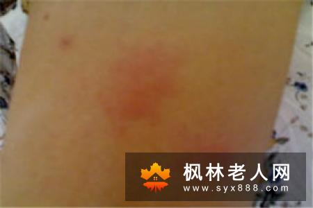 导致老年痴呆的病因有什么？