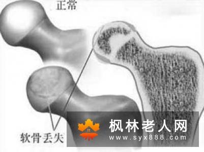 太极拳养生练习太极拳对骨骼关节有哪些好处