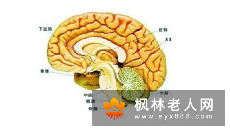老年痴呆的发病原因是什么