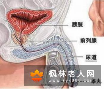 造成老年痴呆的病因是什么？