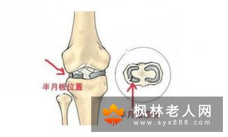 导致老年痴呆的病因有什么？