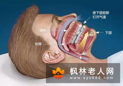 老年痴呆该怎样治疗?