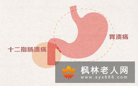早期老年痴呆有什么症状表现？