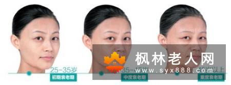 想要去除老年斑 两大食物帮你搞定