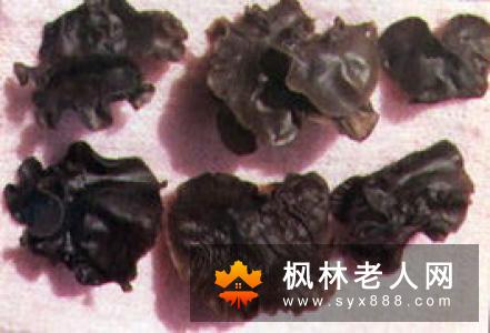 老人补铁要对症  有哪些是需要注意的呢？
