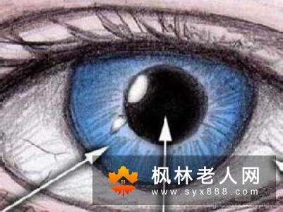 高度近视让年轻人换上白内障