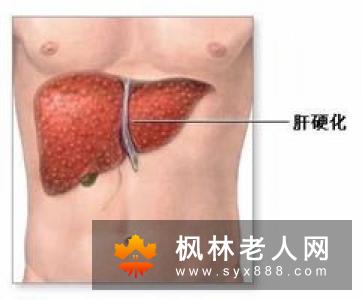 老年人上消化道出血的病因有哪些？