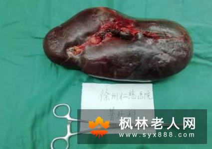 老人吃饭噎是怎么回事 如何改善