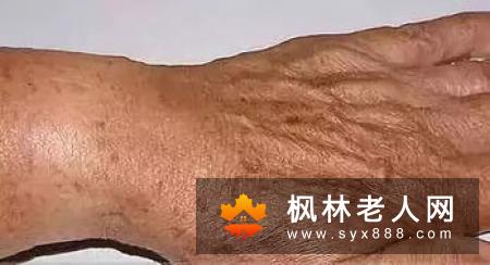 老人延缓衰老的三个动作(1)