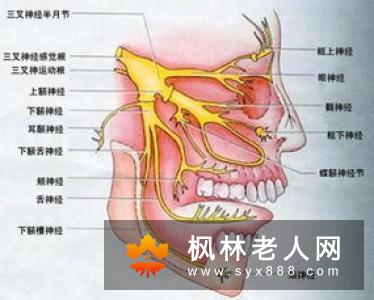 三叉神经痛怎么办？封闭疗法