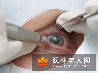 先天性白内障的诊治方法