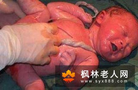 怎样预防长老年斑 老年人可从四方面做好准备