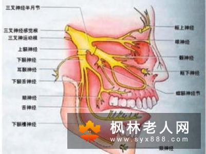 延髓空洞症与三叉神经痛的区别