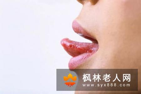 你对口腔溃疡了解多少