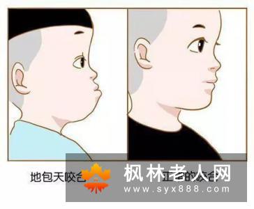 牙周炎都有哪些治疗误区