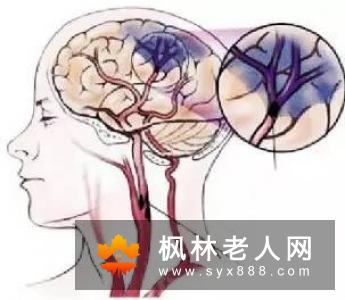 老人头晕吃什么好？这样吃才科学