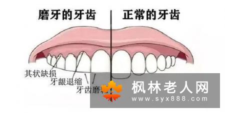 牙周病有哪些危害如何治疗